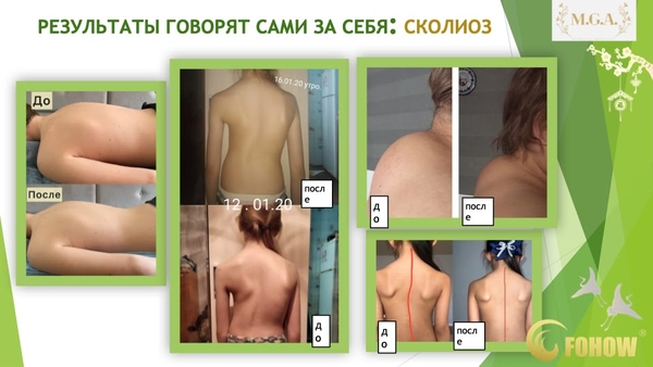 СЕАНС БИОЭНЕРГОМАССАЖА FOHOW 2