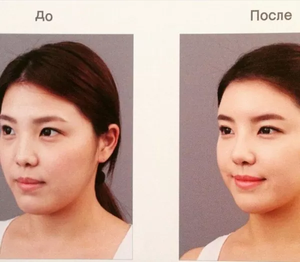 Пластическая хирургия и косметология в Южной Корее 2