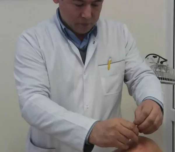 Иглорефлексотерапия в Алматы 2